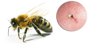 Sudėtis Hondrostrong įeina bitė nuodų, kuris pagerina keitimo procesus audinių