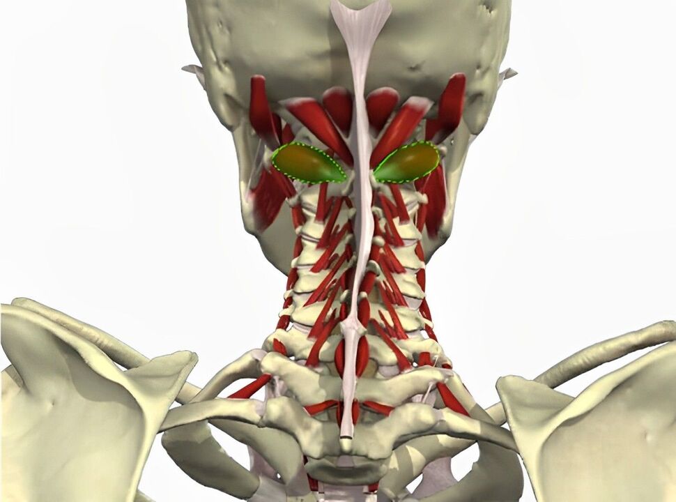 stuburo arterijos sindromas