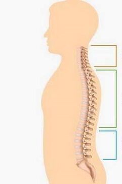 nugalėti skirtingų stuburo dalių osteochondroze